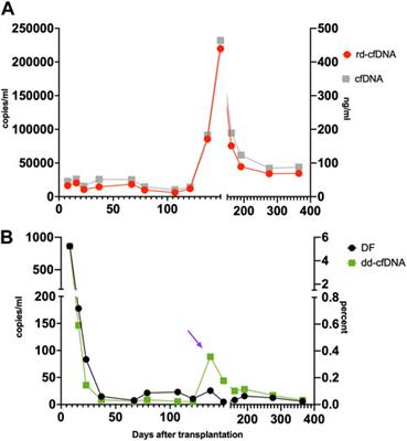 Absolute Quantification of Donor-Derived Cell-Free DNA in Pediatric and Adult Patients After Heart Transplantation: A Prospective Study